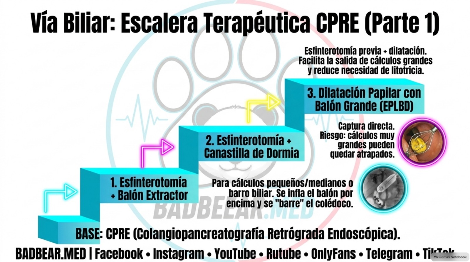 Lámina aportada, página 10: balón extractor, canastilla y apertura papilar. Combina instrumentos y maniobras con funciones distintas; la elección real depende de tamaño, salida y anatomía.