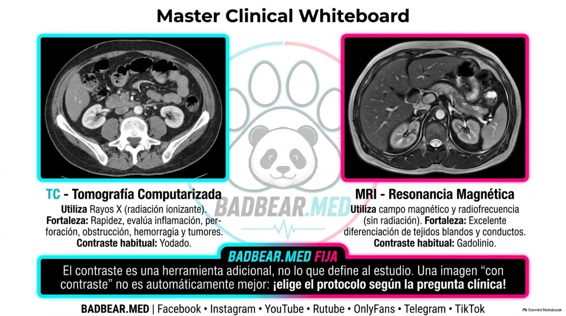 Comparación de principios físicos y fortalezas de TC y RM